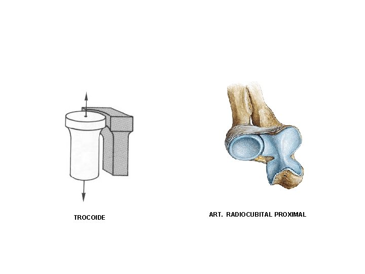 TROCOIDE ART. RADIOCUBITAL PROXIMAL 