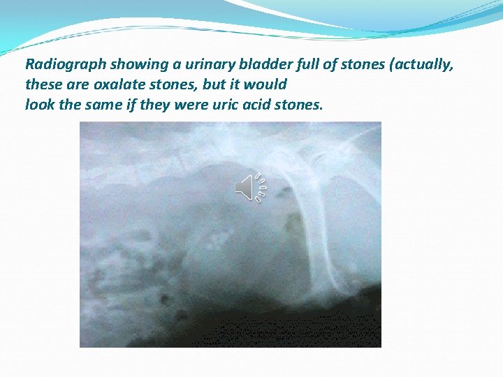  Radiograph showing a urinary bladder full of stones (actually, these are oxalate stones,
