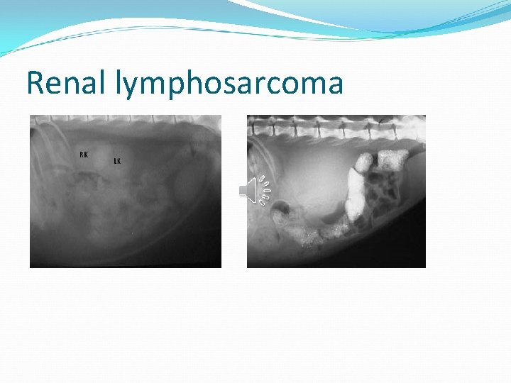 Renal lymphosarcoma 