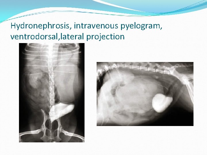 Hydronephrosis, intravenous pyelogram, ventrodorsal, lateral projection 