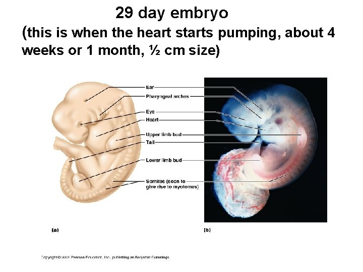 29 day embryo (this is when the heart starts pumping, about 4 weeks or