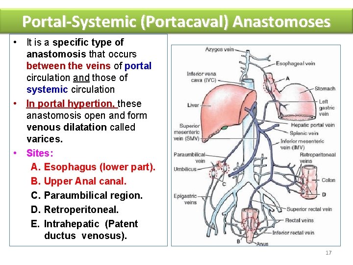 Portal-Systemic (Portacaval) Anastomoses • It is a specific type of anastomosis that occurs between
