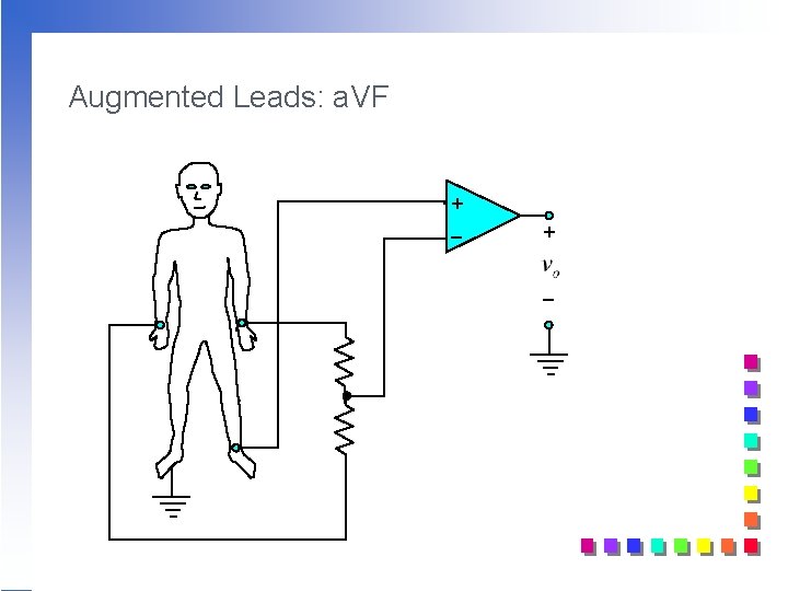 Augmented Leads: a. VF + _ Augmented Leads: a. VF + _