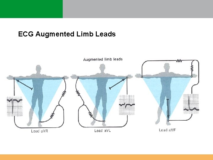 ECG Augmented Limb Leads ECG Augmented Limb Leads