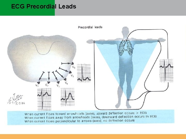 ECG Precordial Leads ECG Precordial Leads