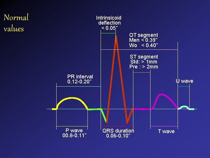 Normal values Intrinsicoid deflection < 0. 05” QT segment Men < 0. 39” Wo Normal values Intrinsicoid deflection < 0. 05” QT segment Men < 0. 39” Wo
