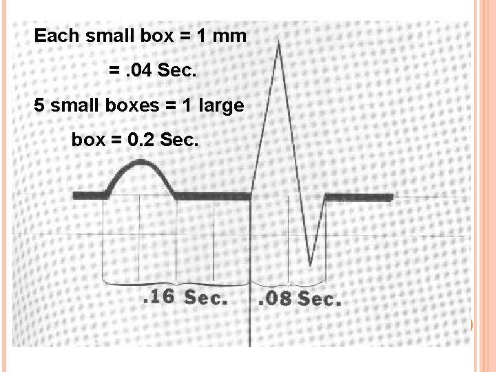 Each small box = 1 mm =. 04 Sec. 5 small boxes = 1 Each small box = 1 mm =. 04 Sec. 5 small boxes = 1