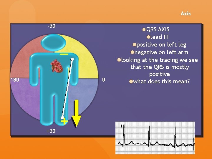 Axis -90 — 180 0 +90 + QRS AXIS lead III positive on left Axis -90 — 180 0 +90 + QRS AXIS lead III positive on left