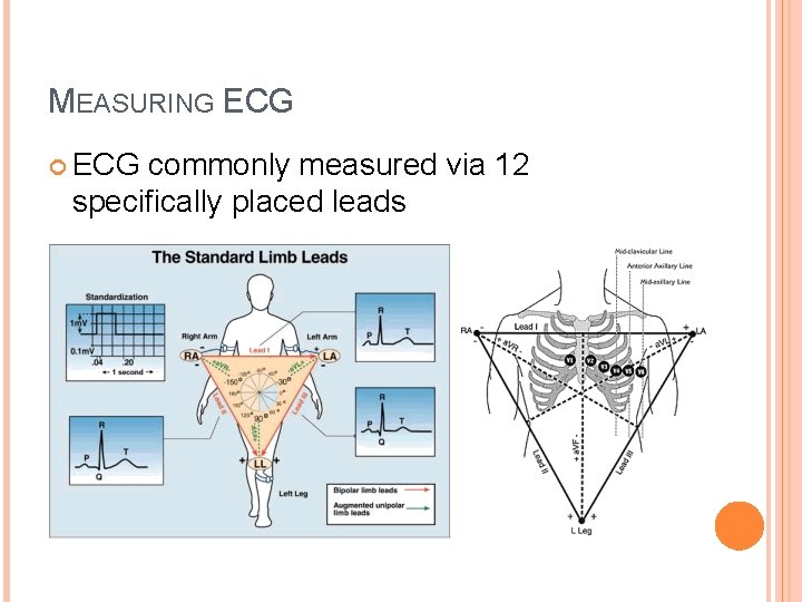 MEASURING ECG commonly measured via 12 specifically placed leads MEASURING ECG commonly measured via 12 specifically placed leads