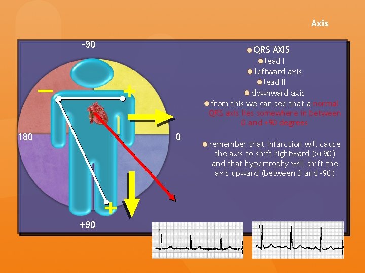 Axis -90 QRS AXIS lead I leftward axis lead II downward axis from this Axis -90 QRS AXIS lead I leftward axis lead II downward axis from this