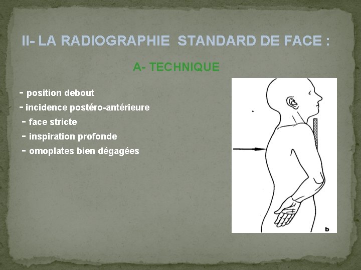 II- LA RADIOGRAPHIE STANDARD DE FACE : A- TECHNIQUE - position debout - incidence