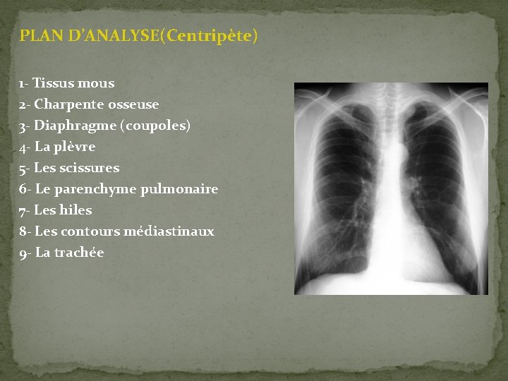 PLAN D’ANALYSE(Centripète) 1 - Tissus mous 2 - Charpente osseuse 3 - Diaphragme (coupoles)