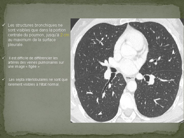 ü Les structures bronchiques ne sont visibles que dans la portion centrale du poumon,