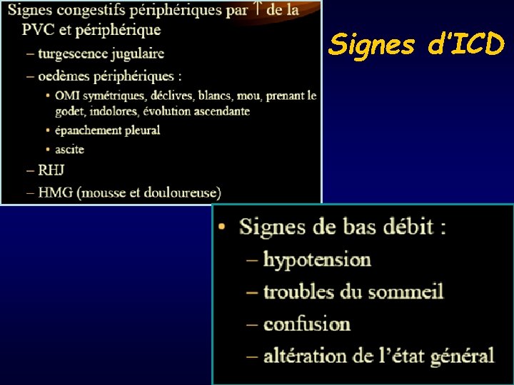 Signes d’ICD 