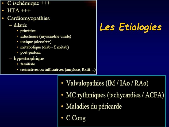 Les Etiologies 