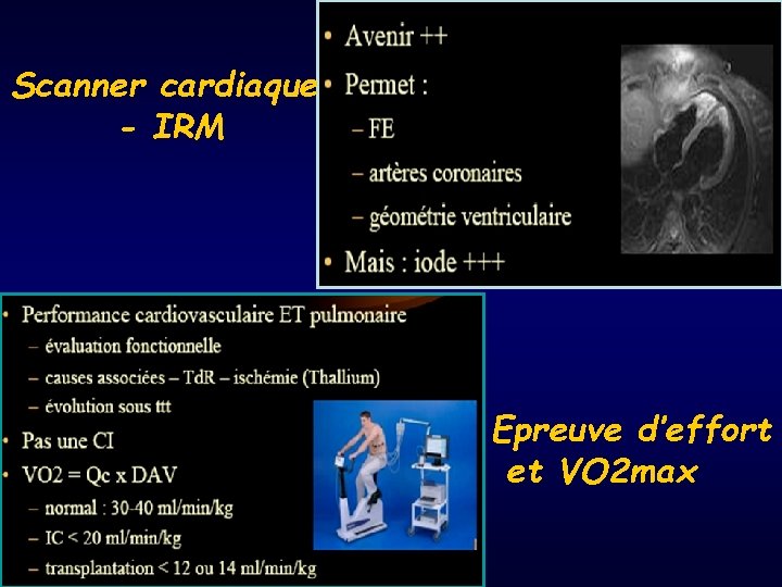 Scanner cardiaque - IRM Epreuve d’effort et VO 2 max 