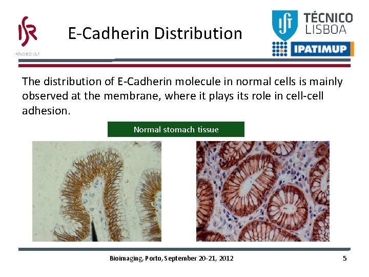 E-Cadherin Distribution The distribution of E-Cadherin molecule in normal cells is mainly observed at E-Cadherin Distribution The distribution of E-Cadherin molecule in normal cells is mainly observed at