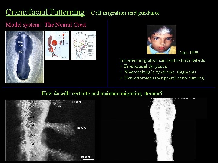 Craniofacial Patterning: Cell migration and guidance Model system: The Neural Crest Cutis, 1999 Incorrect