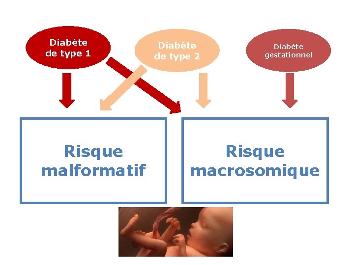 Diabète de type 1 Risque malformatif Diabète de type 2 Diabète gestationnel Risque macrosomique Diabète de type 1 Risque malformatif Diabète de type 2 Diabète gestationnel Risque macrosomique