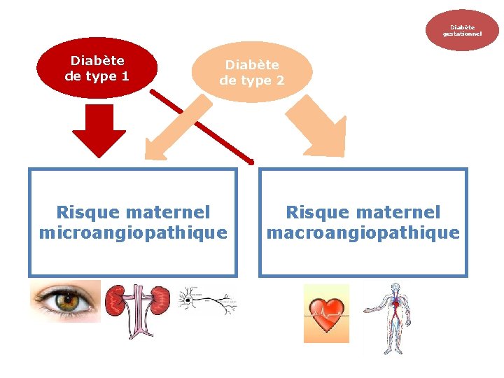 Diabète gestationnel Diabète de type 1 Diabète de type 2 Risque maternel microangiopathique Risque