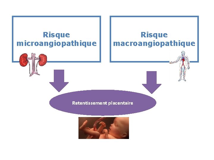 Risque microangiopathique Risque macroangiopathique Retentissement placentaire Risque microangiopathique Risque macroangiopathique Retentissement placentaire