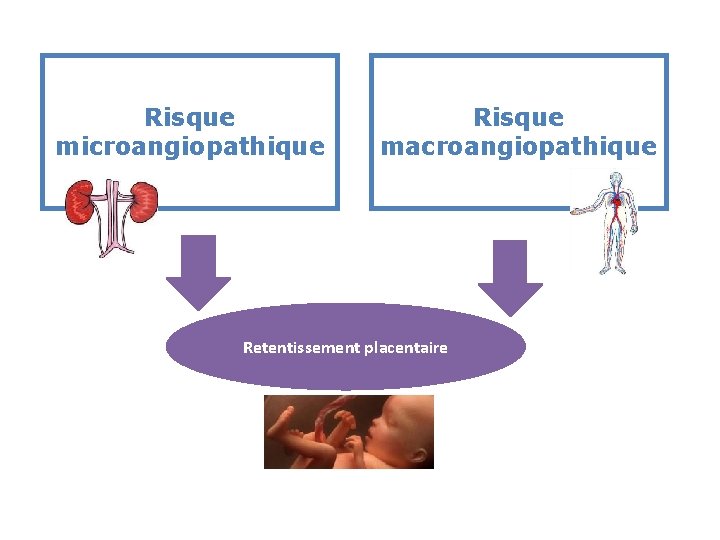 Risque microangiopathique Risque macroangiopathique Retentissement placentaire 