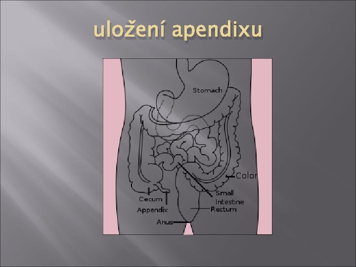 uložení apendixu 
