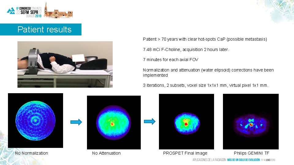 Patient results Patient > 70 years with clear hot-spots Ca. P (possible metastasis) 7. Patient results Patient > 70 years with clear hot-spots Ca. P (possible metastasis) 7.