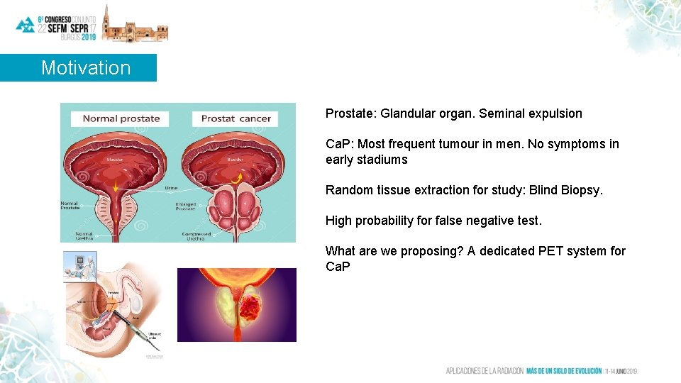 Motivation Prostate: Glandular organ. Seminal expulsion Ca. P: Most frequent tumour in men. No Motivation Prostate: Glandular organ. Seminal expulsion Ca. P: Most frequent tumour in men. No
