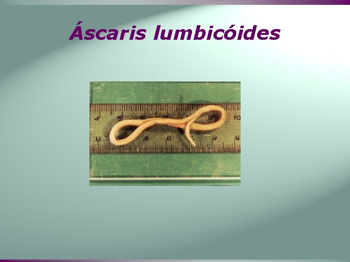 Áscaris lumbicóides 