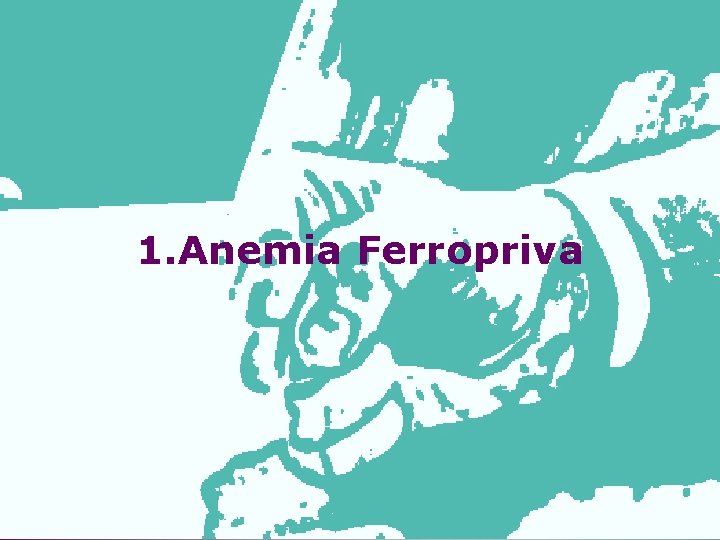 1. Anemia Ferropriva 