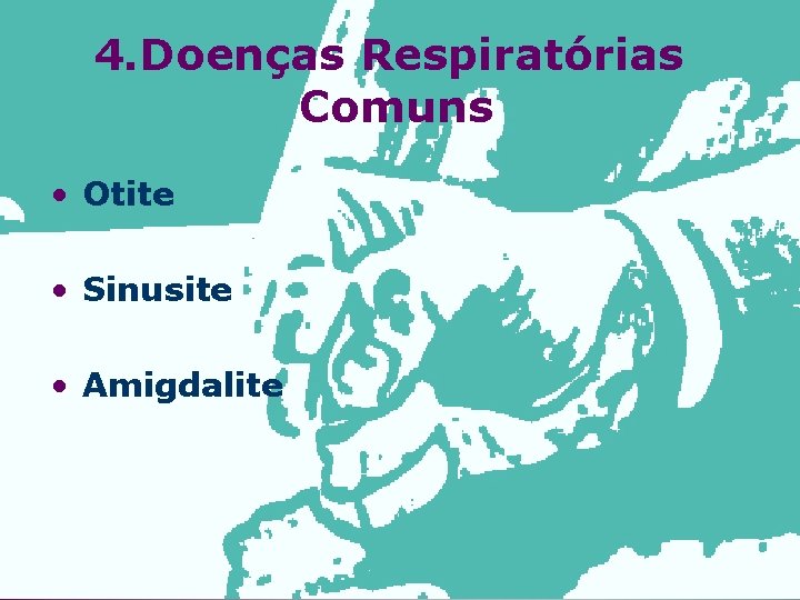 4. Doenças Respiratórias Comuns • Otite • Sinusite • Amigdalite 