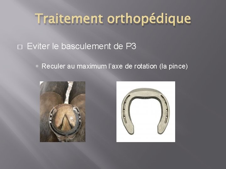 Traitement orthopédique � Eviter le basculement de P 3 Reculer au maximum l’axe de