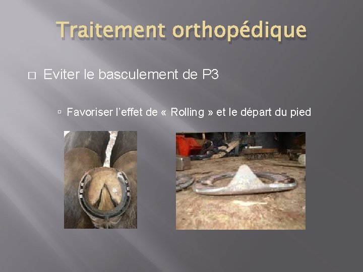 Traitement orthopédique � Eviter le basculement de P 3 Favoriser l’effet de « Rolling