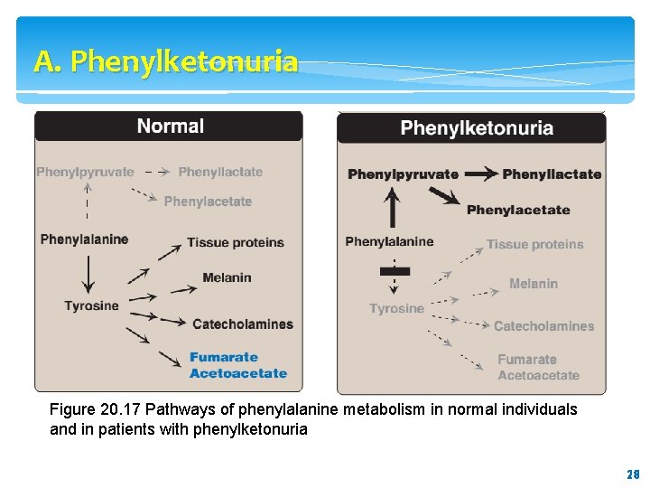 A. Phenylketonuria Figure 20. 17 Pathways of phenylalanine metabolism in normal individuals and in