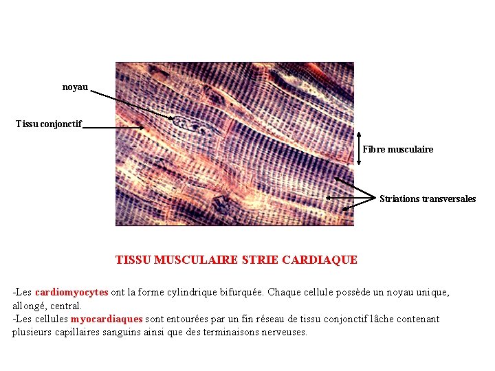 noyau Tissu conjonctif Fibre musculaire Striations transversales TISSU MUSCULAIRE STRIE CARDIAQUE -Les cardiomyocytes ont noyau Tissu conjonctif Fibre musculaire Striations transversales TISSU MUSCULAIRE STRIE CARDIAQUE -Les cardiomyocytes ont