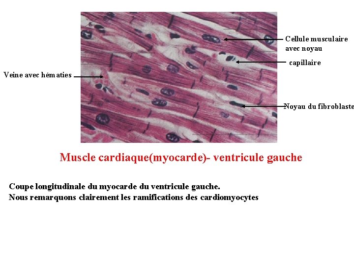 Cellule musculaire avec noyau capillaire Veine avec hématies Noyau du fibroblaste Muscle cardiaque(myocarde)- ventricule Cellule musculaire avec noyau capillaire Veine avec hématies Noyau du fibroblaste Muscle cardiaque(myocarde)- ventricule