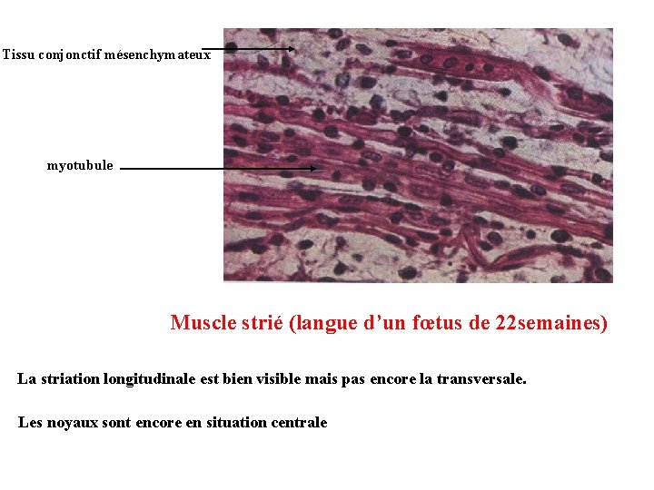 Tissu conjonctif mésenchymateux myotubule Muscle strié (langue d’un fœtus de 22 semaines) La striation