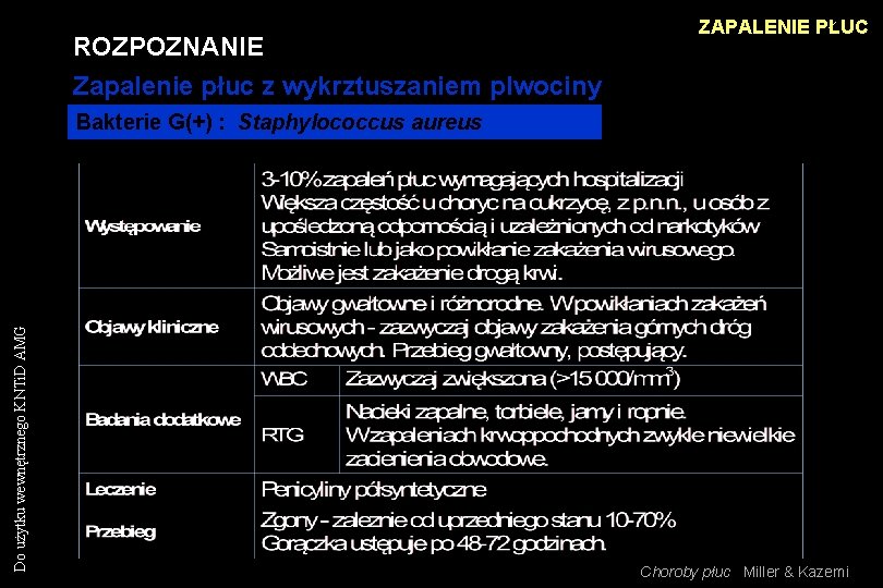 ROZPOZNANIE Zapalenie płuc z wykrztuszaniem plwociny ZAPALENIE PŁUC Do użytku wewnętrznego KNTi. D AMG