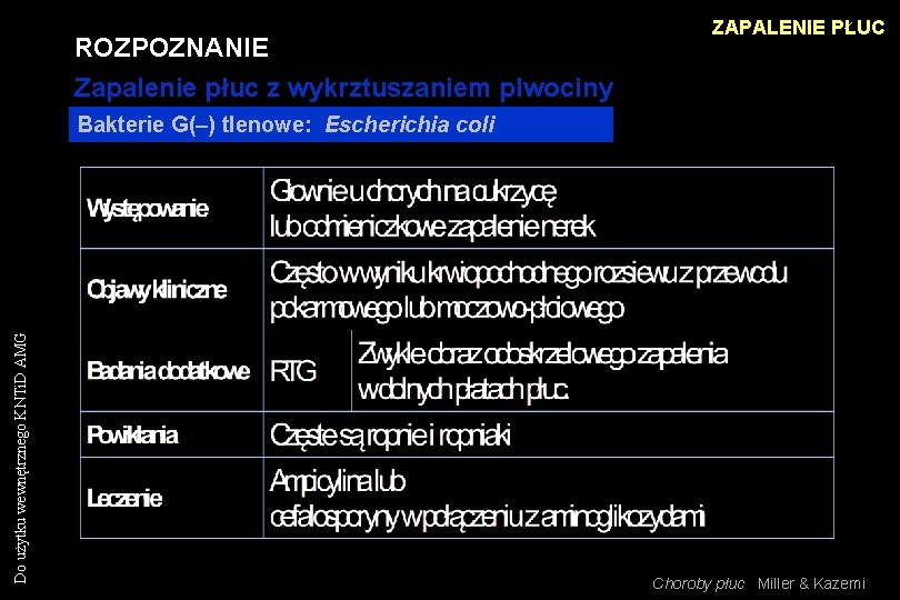 ROZPOZNANIE Zapalenie płuc z wykrztuszaniem plwociny ZAPALENIE PŁUC Do użytku wewnętrznego KNTi. D AMG