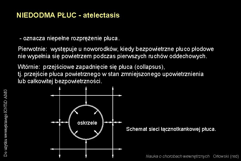 NIEDODMA PŁUC - atelectasis - oznacza niepełne rozprężenie płuca. Pierwotnie: występuje u noworodków, kiedy