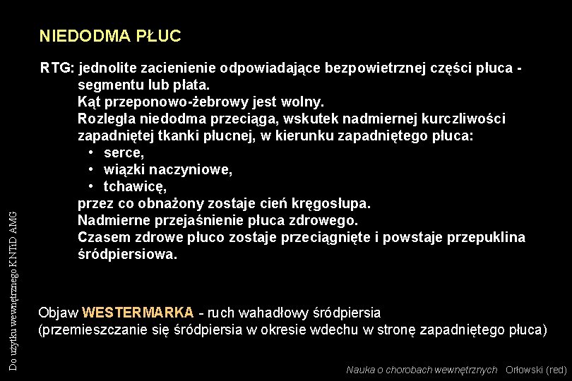 Do użytku wewnętrznego KNTi. D AMG NIEDODMA PŁUC RTG: jednolite zacienienie odpowiadające bezpowietrznej części