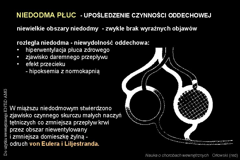 NIEDODMA PŁUC - UPOŚLEDZENIE CZYNNOŚCI ODDECHOWEJ niewielkie obszary niedodmy - zwykle brak wyraźnych objawów