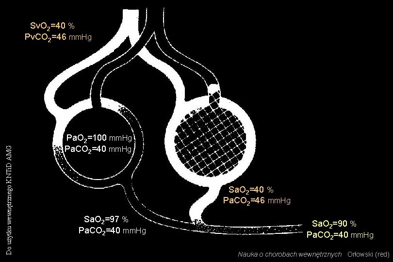 Do użytku wewnętrznego KNTi. D AMG Sv. O 2=40 % Pv. CO 2=46 mm.