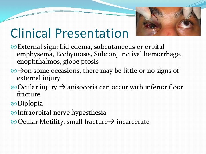 Clinical Presentation External sign: Lid edema, subcutaneous or orbital emphysema, Ecchymosis, Subconjunctival hemorrhage, enophthalmos,