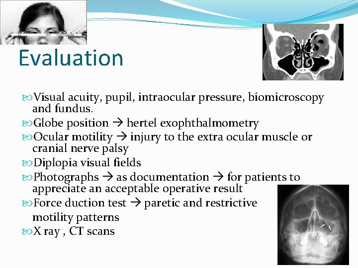 Evaluation Visual acuity, pupil, intraocular pressure, biomicroscopy and fundus. Globe position hertel exophthalmometry Ocular