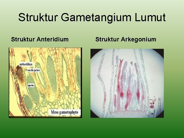 Struktur Gametangium Lumut Struktur Anteridium Struktur Arkegonium 