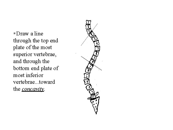 § Draw a line through the top end plate of the most superior vertebrae,