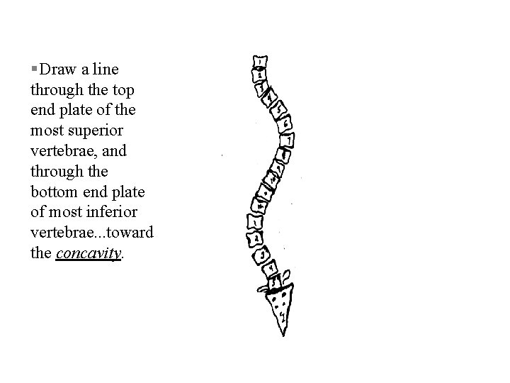 § Draw a line through the top end plate of the most superior vertebrae,