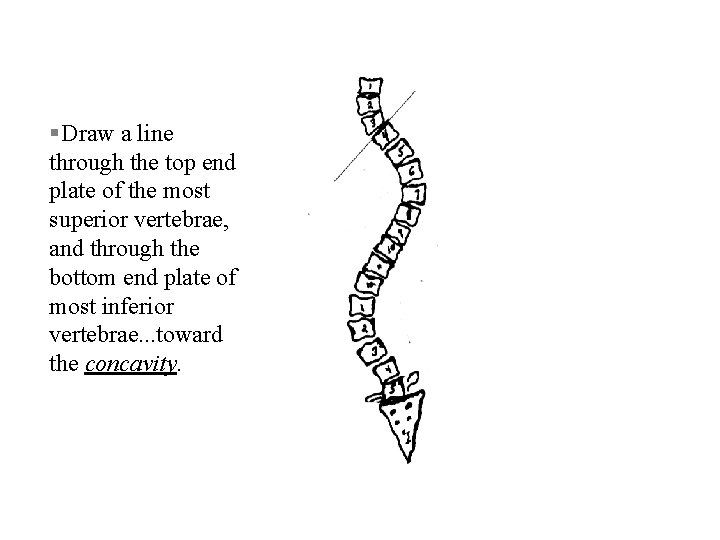 § Draw a line through the top end plate of the most superior vertebrae,